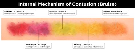 Contusion Heal Time