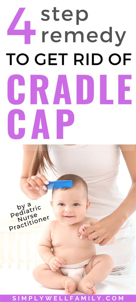 Cradle Cap Treatments: Fast And Gentle Cure For Babies