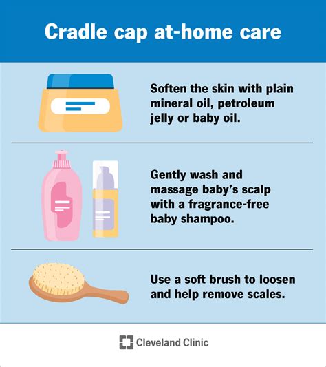 Cradle Cap Treatments