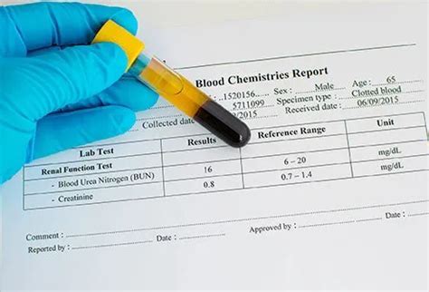 Creatinine Blood Test Low: Understand Results