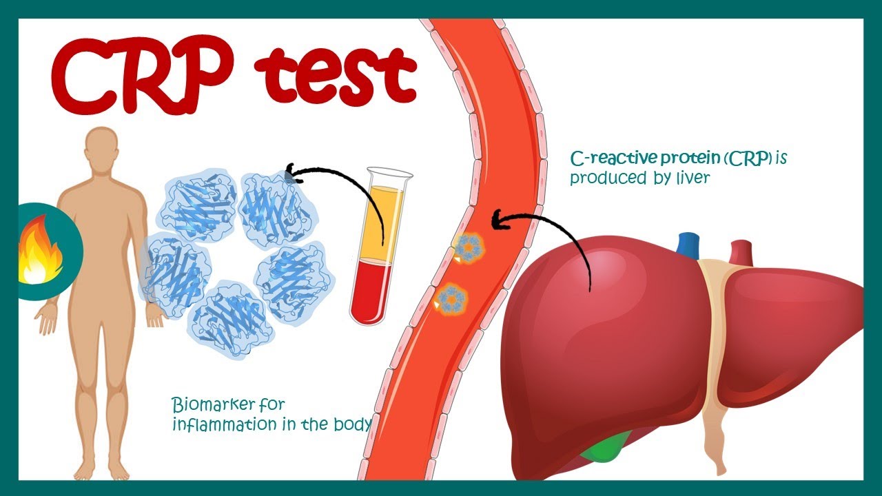 Crp Blood Report