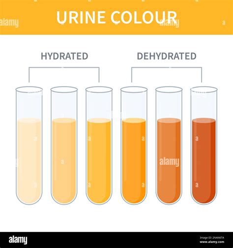 Dehydration Colour Of Urine