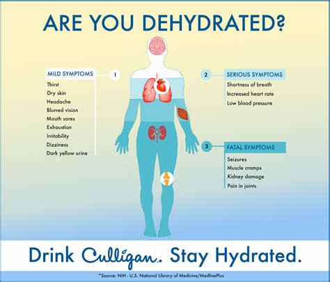 Dehydration Signs: Stay Hydrated Always