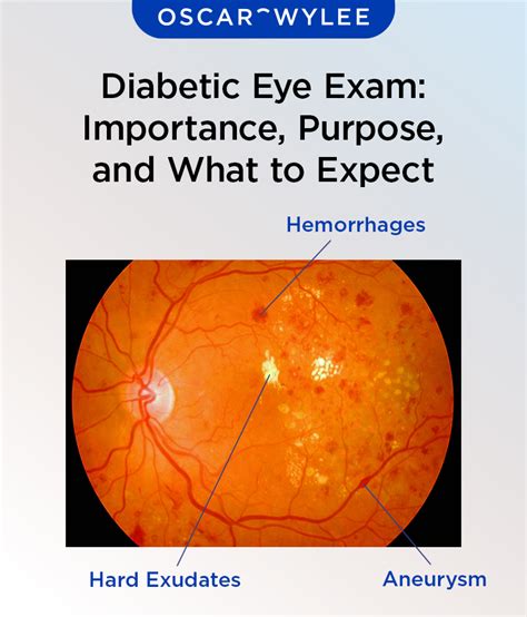 Diabetes Eyesight Test Guide: Protect Vision