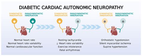 Diabetic Autonomic Neuropathy: Manage Your Symptoms