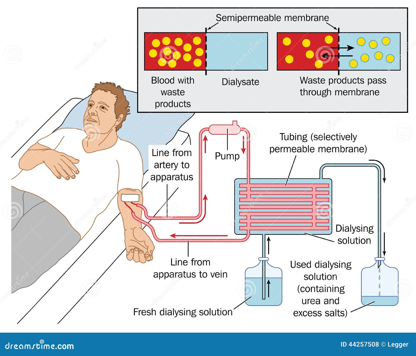 Dialysis Care Guide: Choose Top Local Clinics