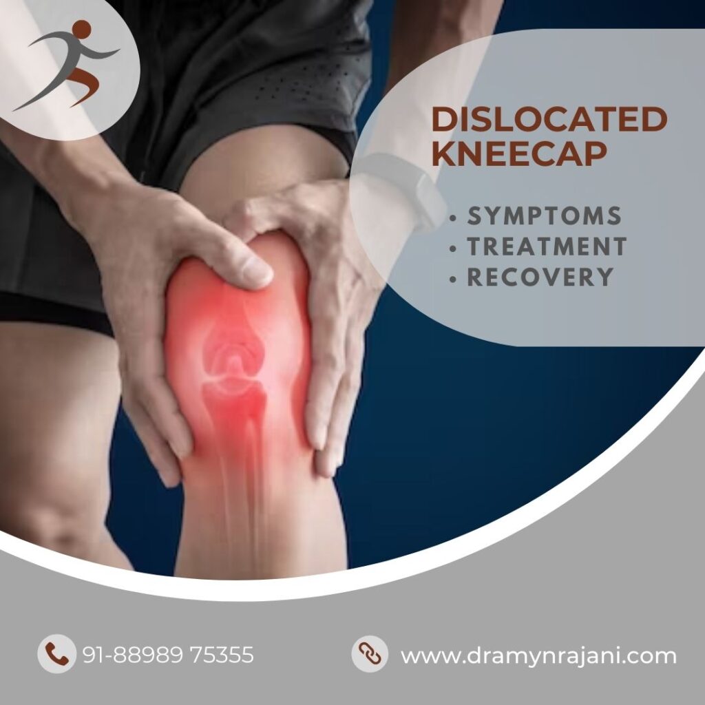 Dislocated Kneecap Recovery: Get Back On Track In 6 Weeks