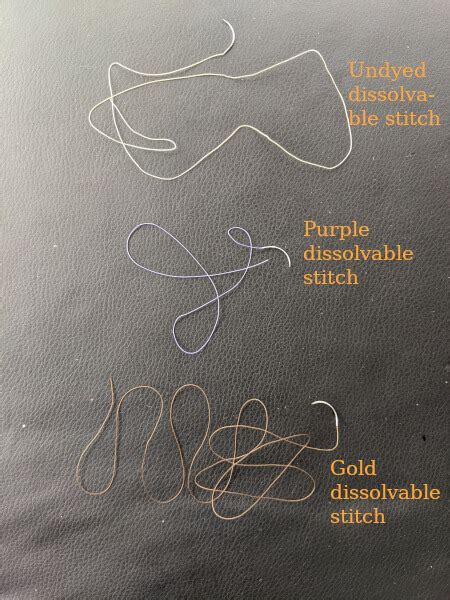 Dissolvable Surgical Stitches