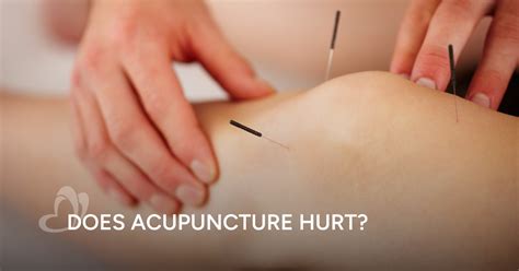 Does Acupuncture Hurt
