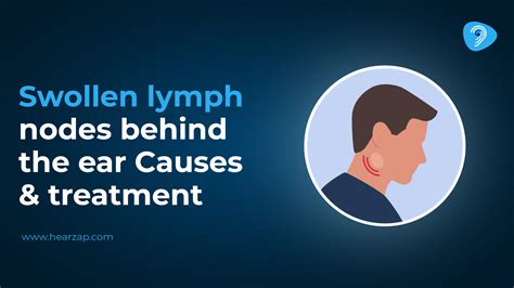 Ear Lymph Node Care: Diagnosis And Treatment