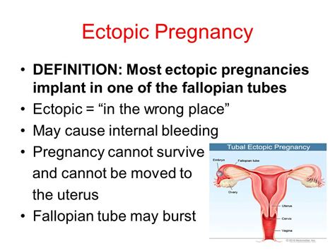 Ectopic Meaning Unveiling The Origins Of Ectopic Bones Insights From Ectopic Meaning Unveiling The Origins Of Ectopic Bones Insights From