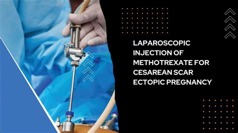 Ectopic Pregnancy Surgery