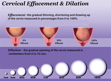 Effaced Cervix Meaning