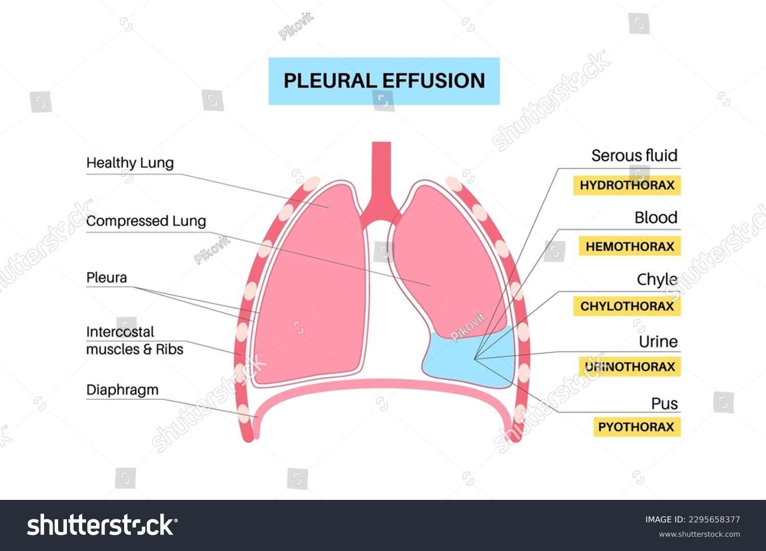 Effusion Explained: Master The Process