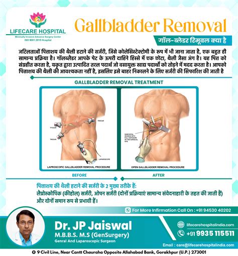 Emergency Gallbladder Surgery