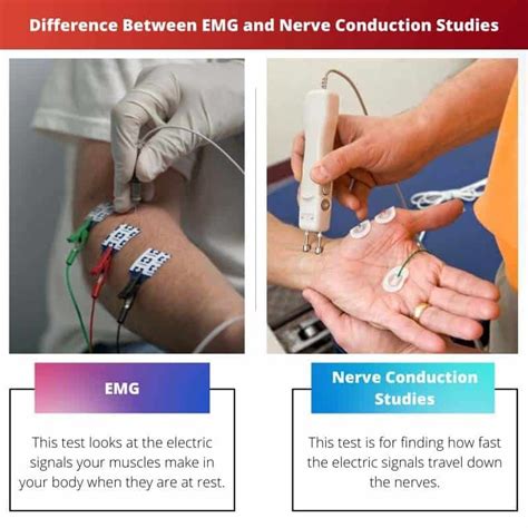 Emg Vs Nerve Conduction Studies Difference And Comparison Emg Vs Nerve Conduction Studies Difference And Comparison