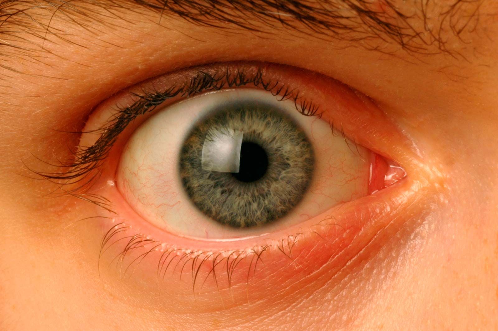 Eye Doctor Louisville Ky