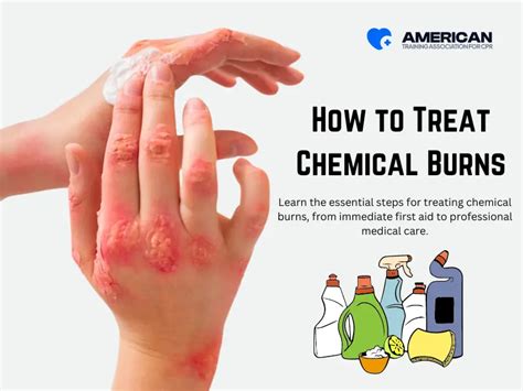 Face Chemical Burn Care: Comprehensive Healing Guide
