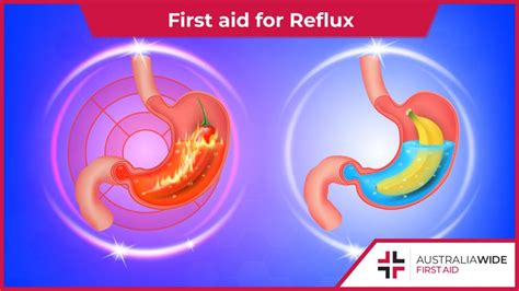 First Aid For Reflux Heartburn First Aid For Reflux Heartburn