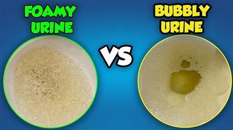 Foam In Urine Causes Explained
