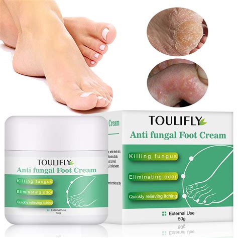 Fungal Cream Foot