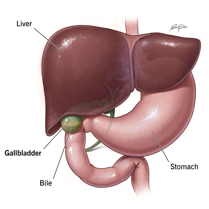 Gallbladder Surgery: Heal Quickly With Expert Tips
