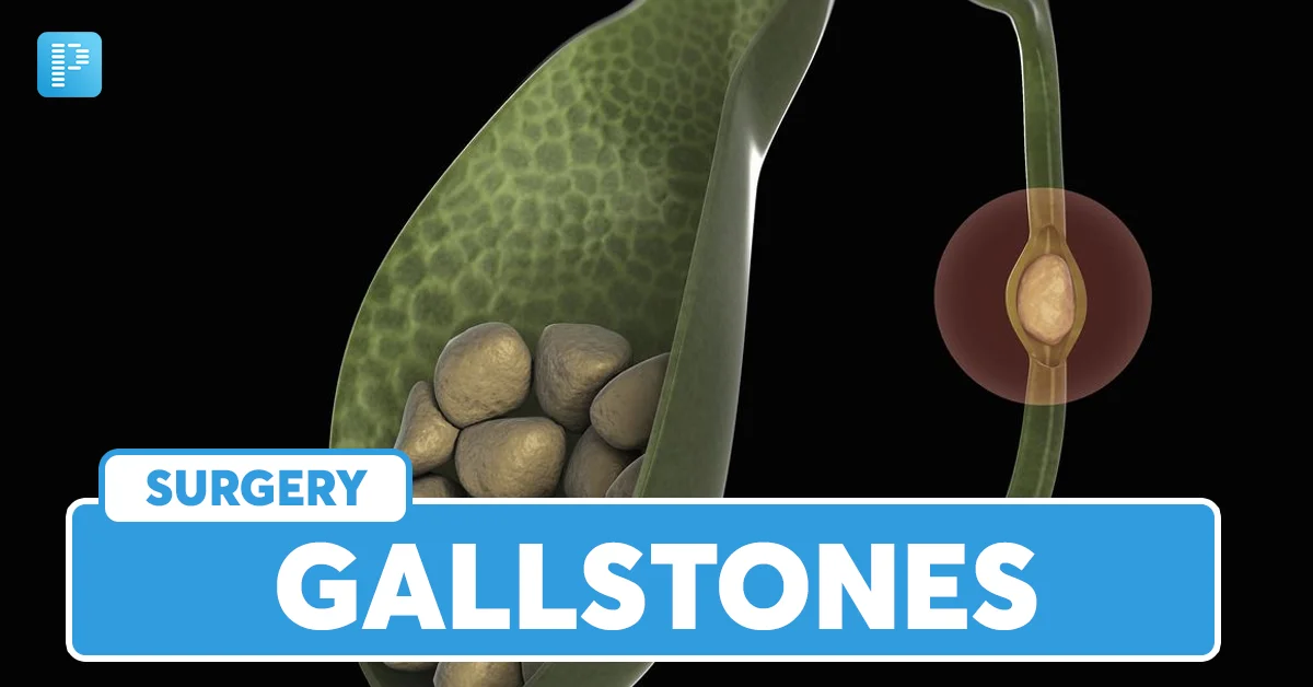 Gallstones In The Gallbladder