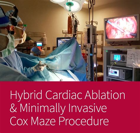 Heart Ablation Procedure: Minimally Invasive