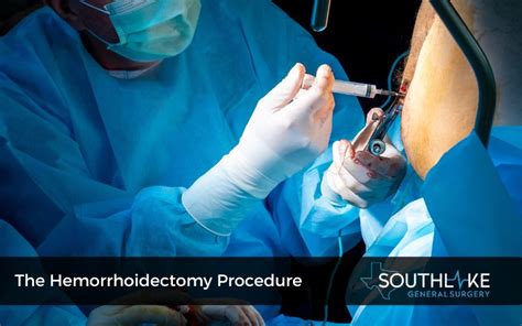 Hemorrhoid Removal: Painless Procedure For Lasting Relief