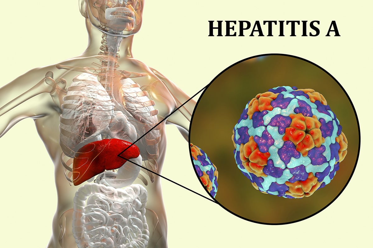 Hepatitis A Antibodies Hep A Ab Igm Test Smartly Labs