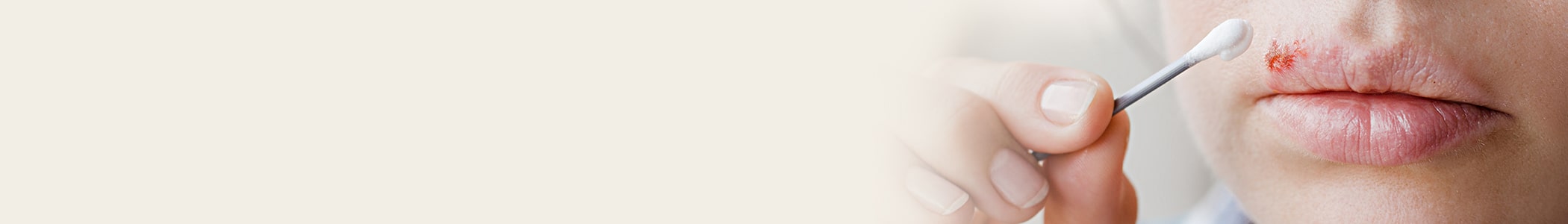 Herpes Check: Get Accurate Test Results