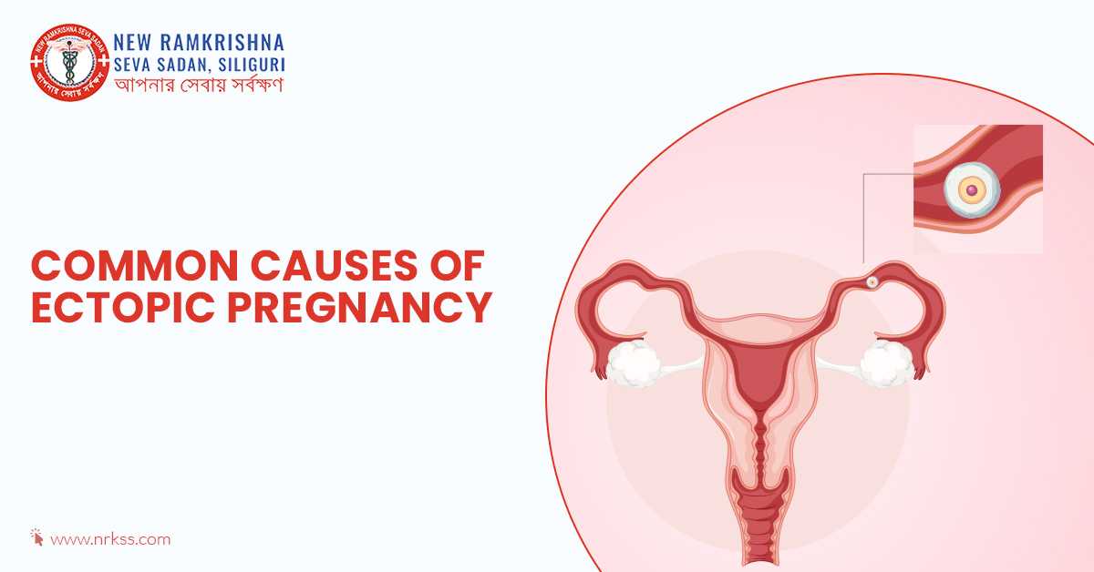 How Common Is Ectopic Pregnancy