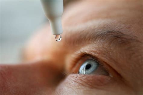 How Do Steroid Eye Drops Work? Effective Treatment