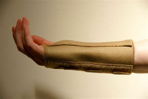 How Does A Splint Help Carpal Tunnel At Craig Alston Blog How Does A Splint Help Carpal Tunnel At Craig Alston Blog