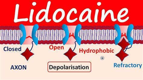 How Does Lidocaine Work