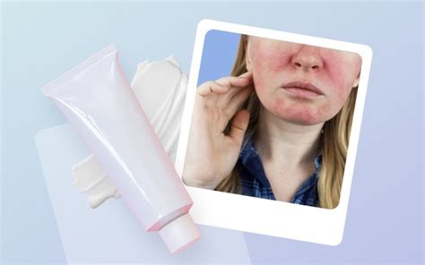 How Does Metronidazole Gel Work? Clear Skin