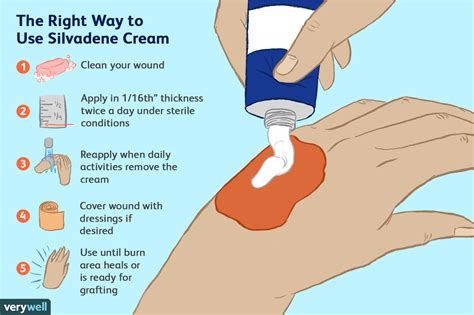 How Does Silver Sulfadiazine Cream Work? Wound Healing Guide