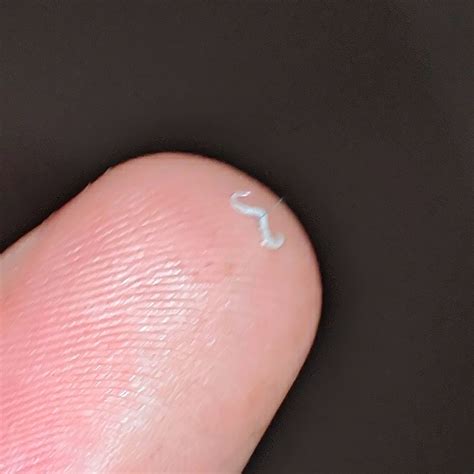 How To Check For Pinworms