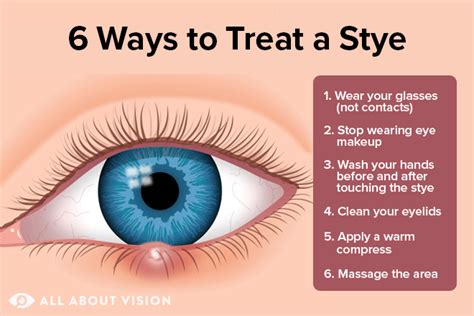 How To Cure Stye? Over Counter Meds Guide