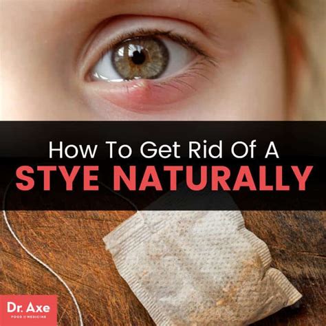 How To Get Rid Of A Stye Follow These 5 Home Remedies Dr Axe How To Get Rid Of A Stye Follow These 5 Home Remedies Dr Axe