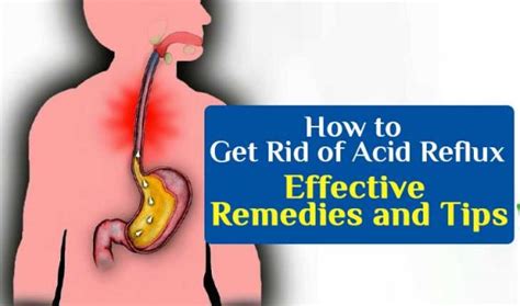 How To Get Rid Of Acid Reflux Effective Remedies And Tips Explain Here How To Get Rid Of Acid Reflux Effective Remedies And Tips Explain Here