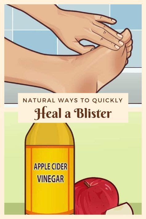 How To Heal Blisters