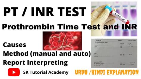 How To Lower Inr Levels? Protime Test Guidance