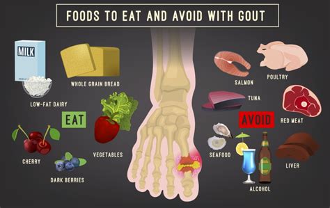 How To Prevent Gout? Diet Solutions