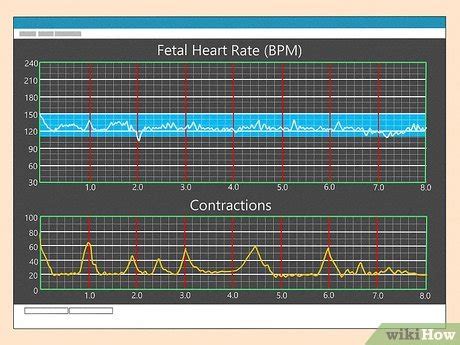 How To Read Contraction Monitor