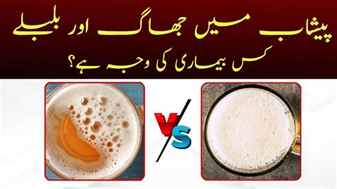 How To Reduce Frothiness In Urine? Fast Relief Tips