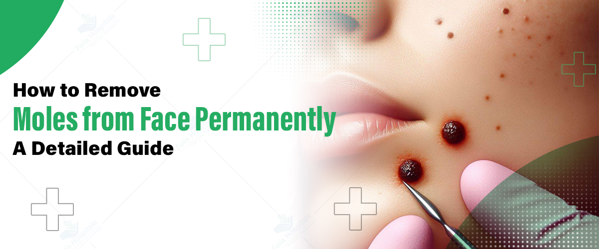 How To Remove Moles From Face Naturally 3 Best Home Remedies To