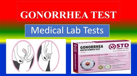 How To Test For Gonorrhea