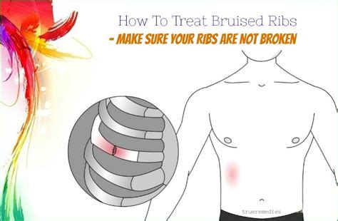 How To Treat Bruised Ribs
