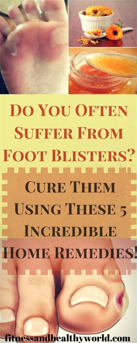 How To Treat Foot Blisters? Instant Relief